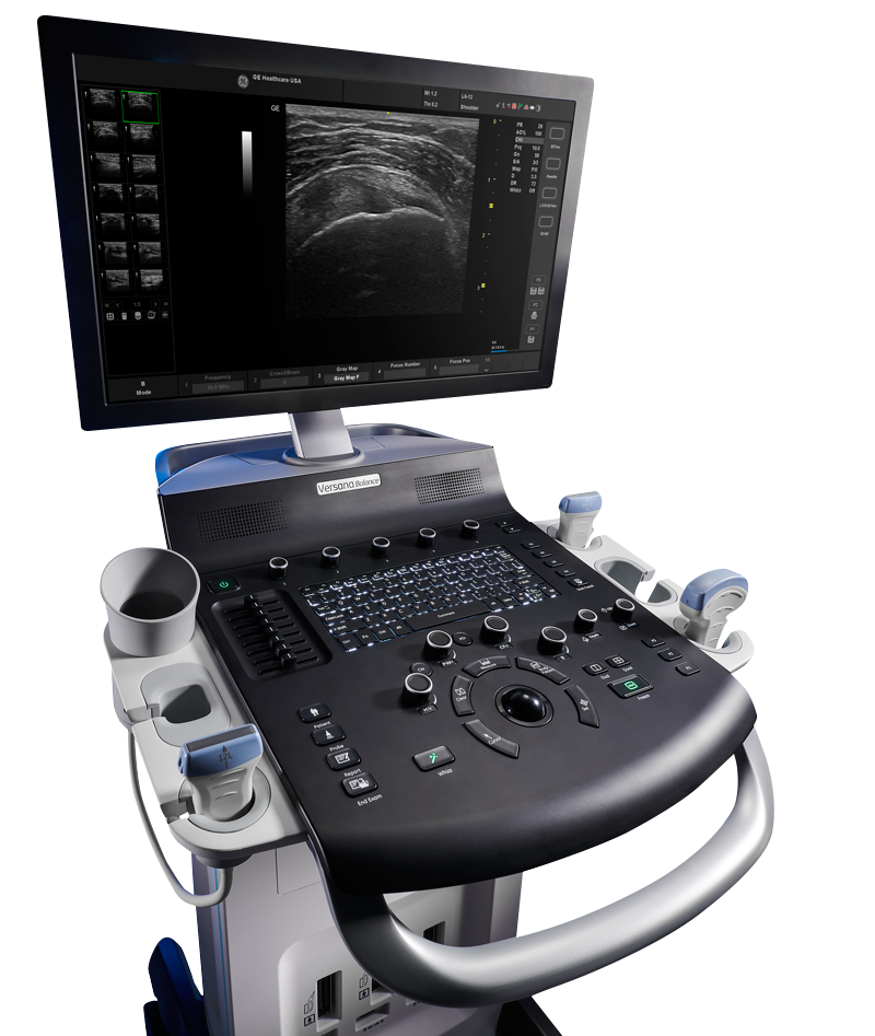 Versana Geräte zur Ultraschalldiagnostik bei Kröner Medizintechnik